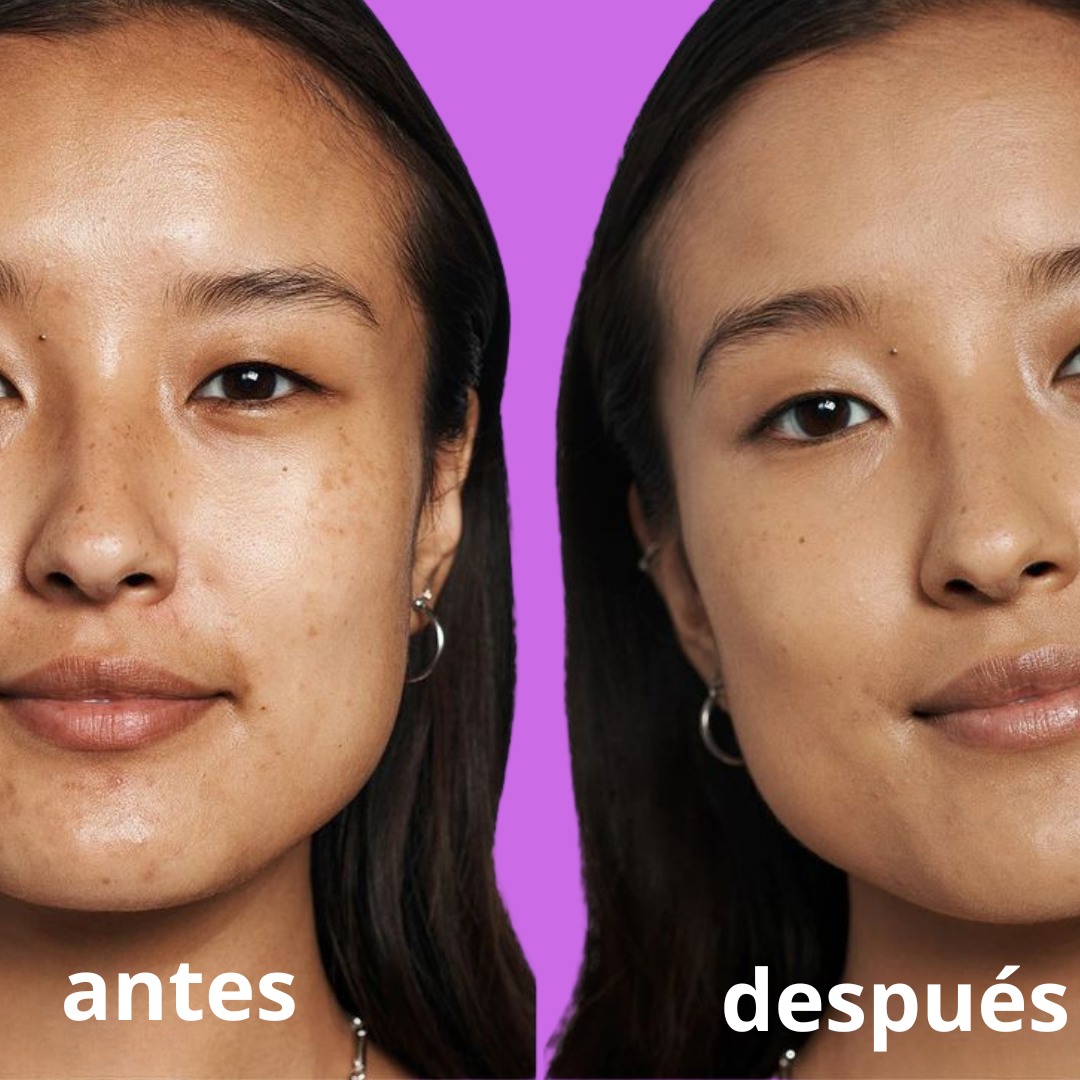 Despídete de las manchas-corrector total