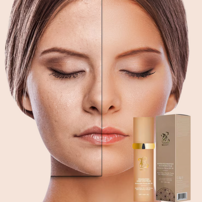 Rostro sin manchas-Piel perfecta en segundos