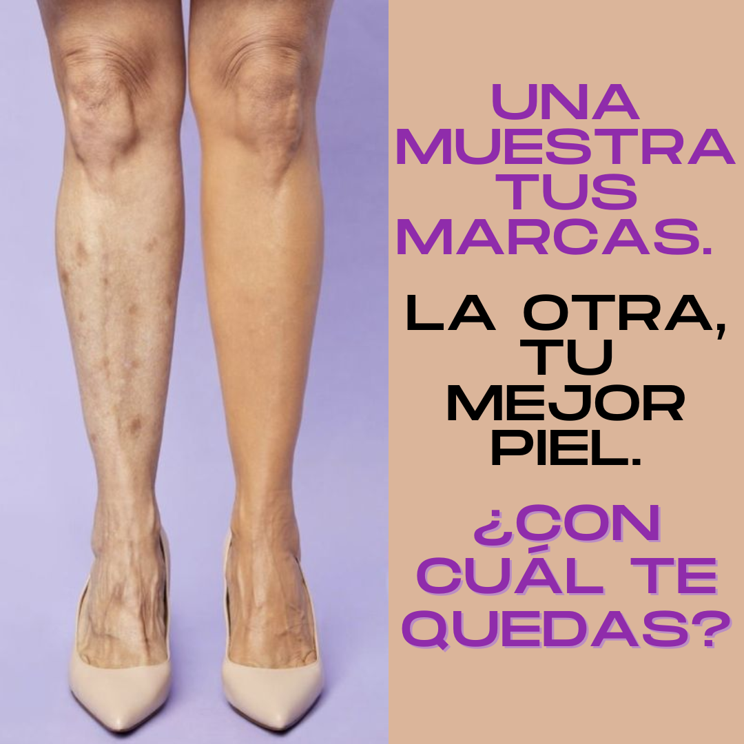 Despídete de las manchas-corrector total