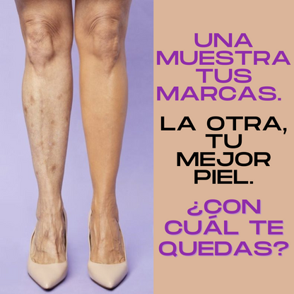 Despídete de las manchas-corrector total